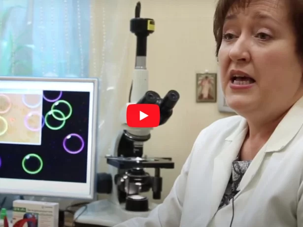 Збільшене зображення капілярів під мікроскопом